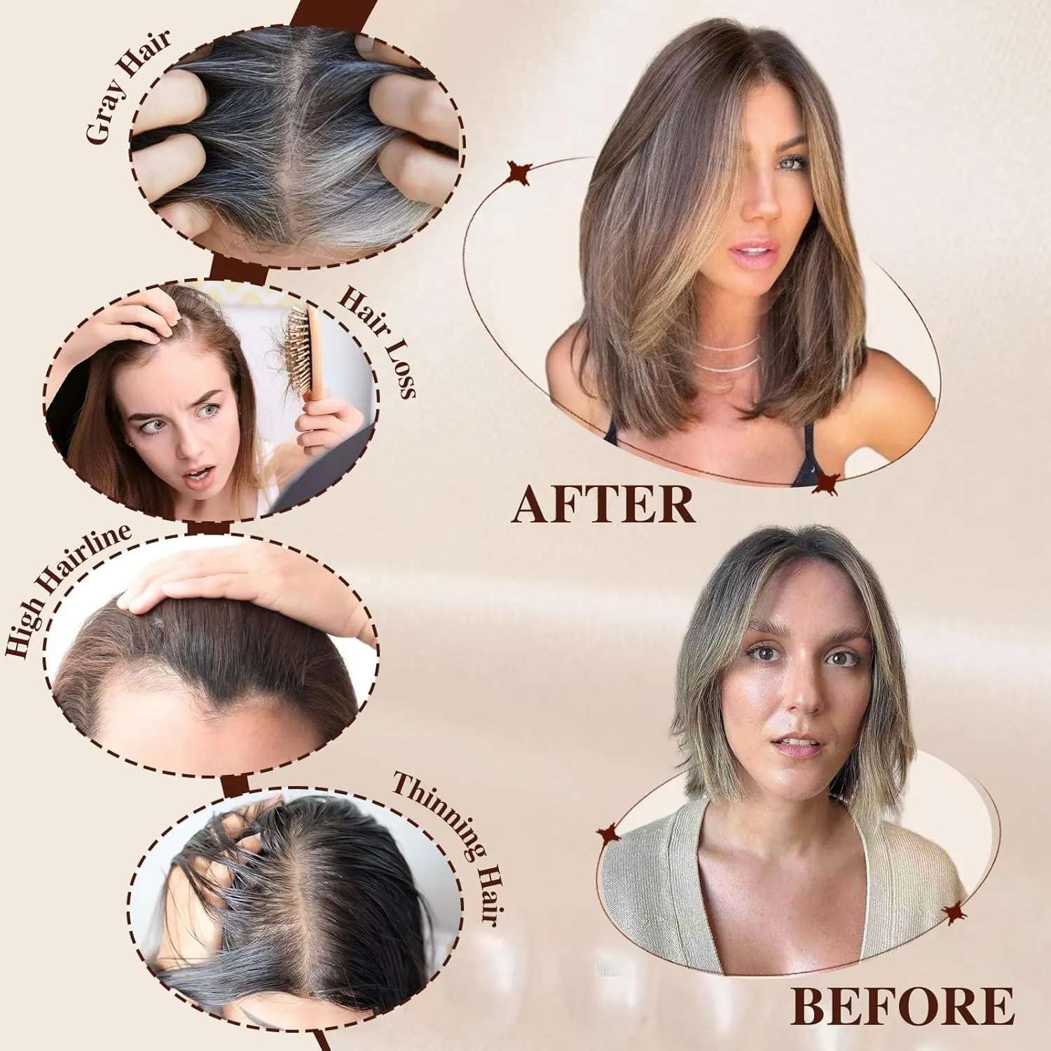 starluck 14 Inch Light Blonde & Brown Hair Toppers for Women Synthetic Hair Toppers Hair Pieces Swiss Base with 3 Clips in Wiglets Toppers for Women with Thinning Hair Grey Hair Hair Loss